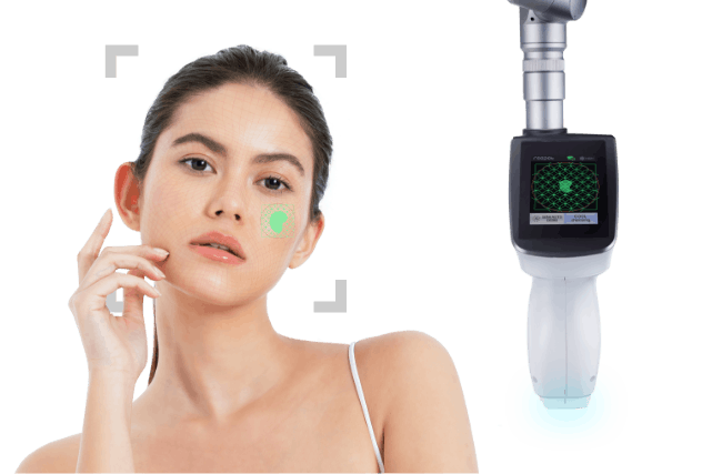 リポットレーザー オートスキャニングの画像