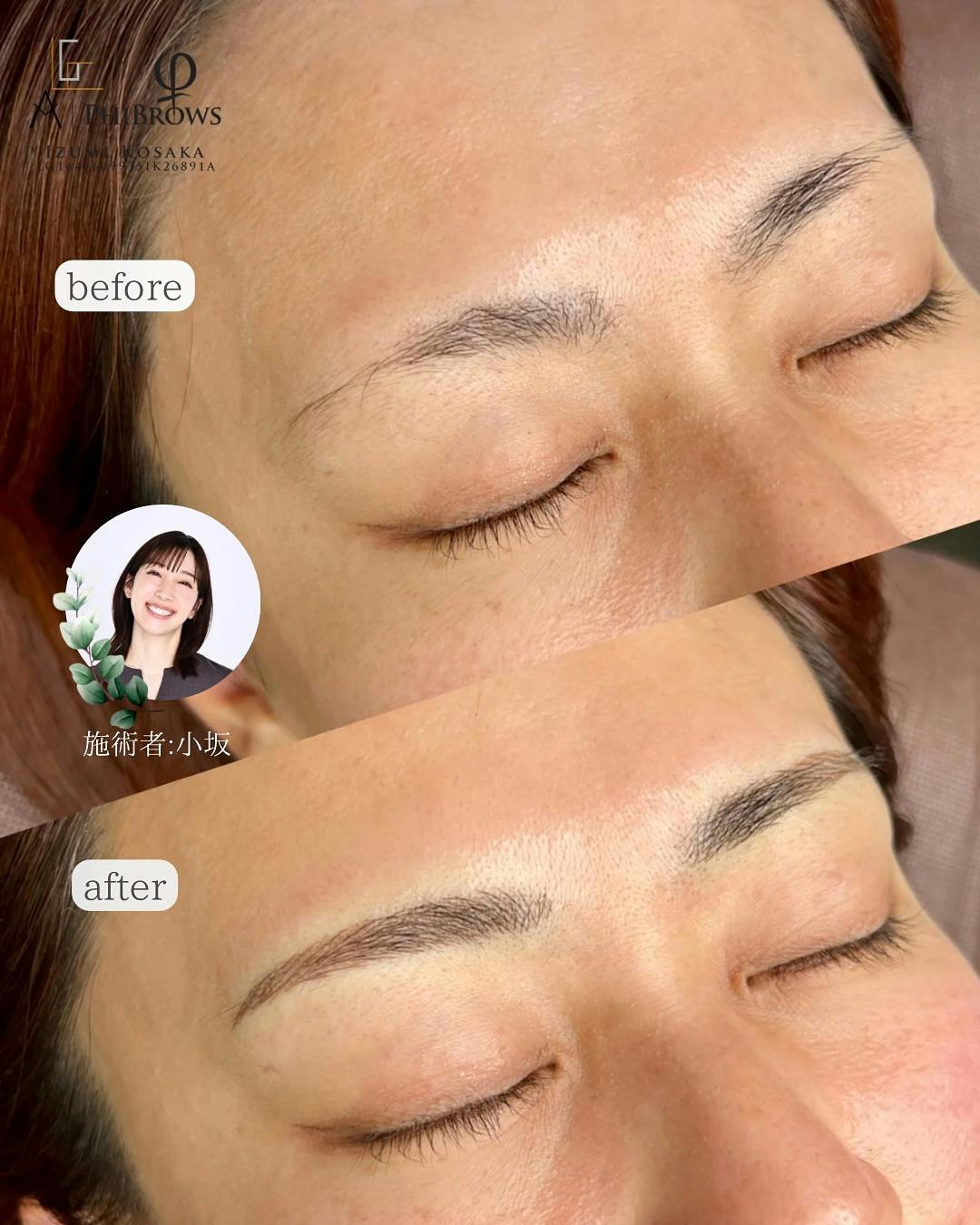 【女性・眉】眉のアートメイク_before_aftar