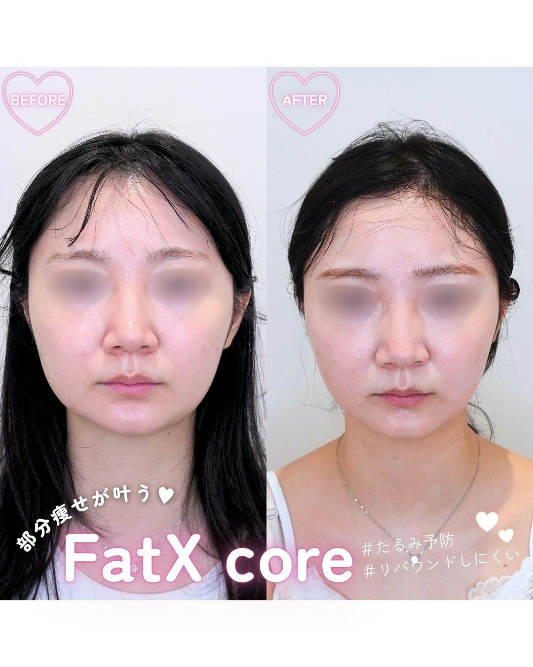 【女性・顔】FatX core_before_aftar