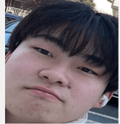 品川美容外科 名古屋院でほくろ・いぼ除去を受けたyossyさんの写真