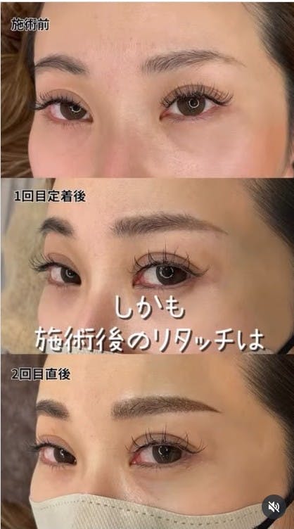 【女性・眉】アートメイク_before_aftar