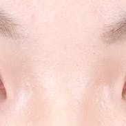 【女性・目元】クイックコスメティーク・ダブルNeo_aftar