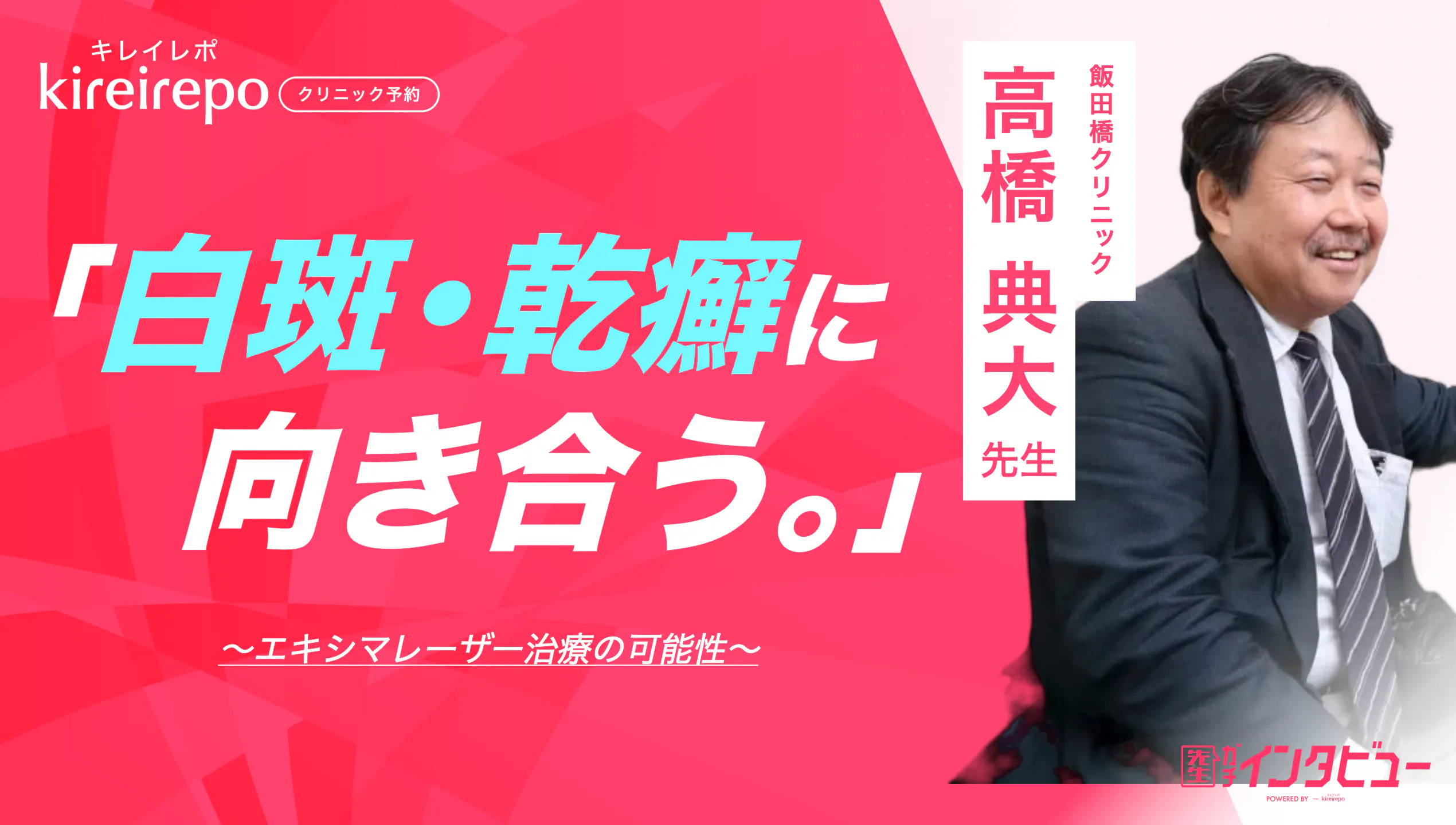 美容医療(自由診療・審美歯科)のプラットフォーム「キレイレポ」に「エキシマレーザー治療」の記事が掲載されました。