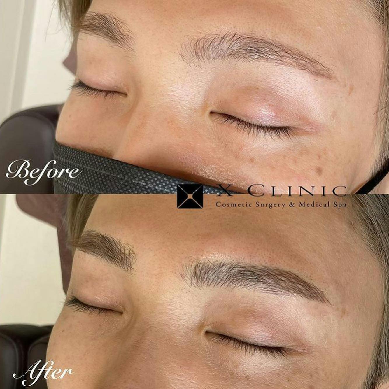 【男性・眉】眉毛アートメイク_before_aftar