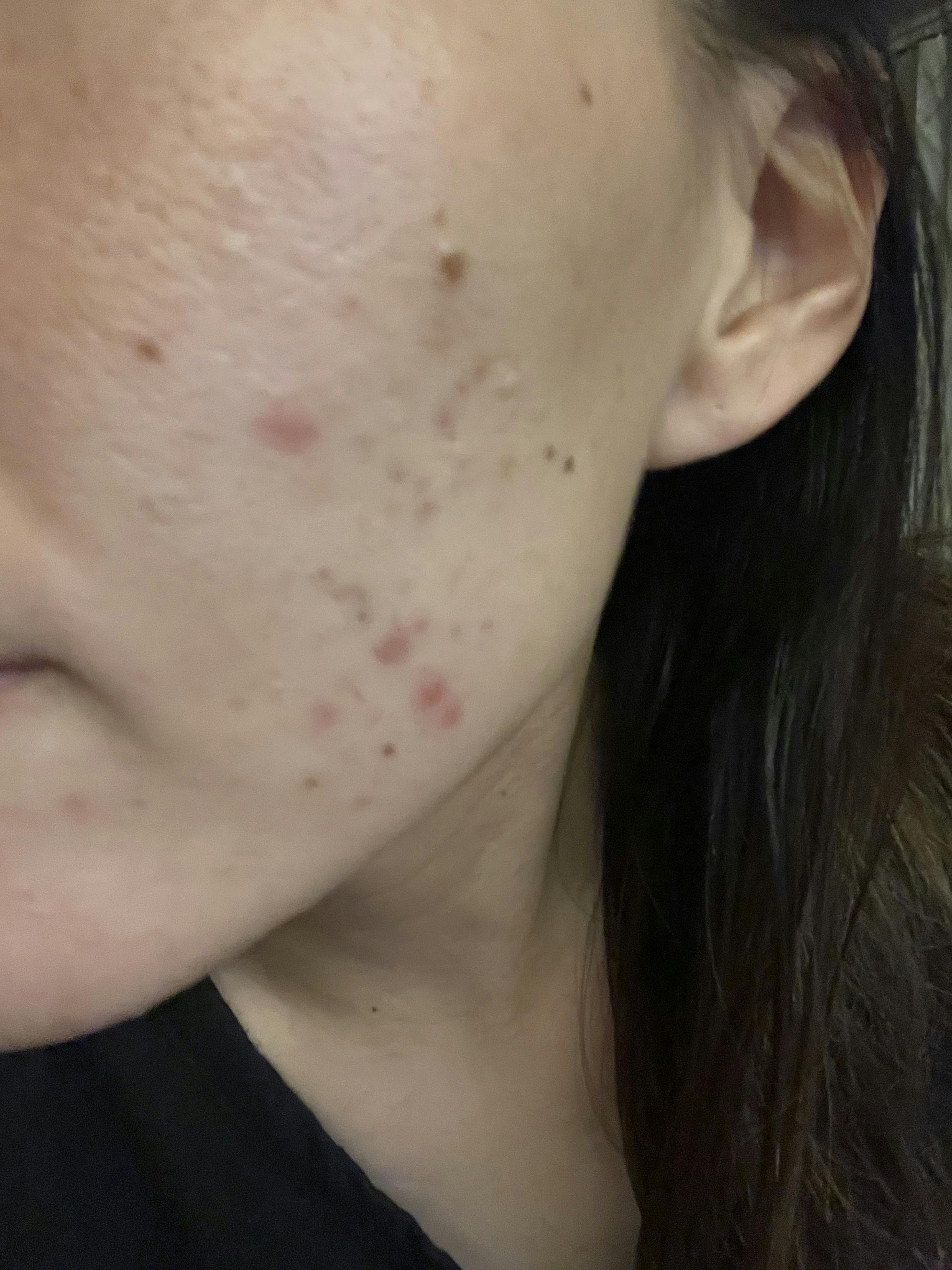 湘南美容クリニック 奈良院でを受けたmちゃんさんの写真