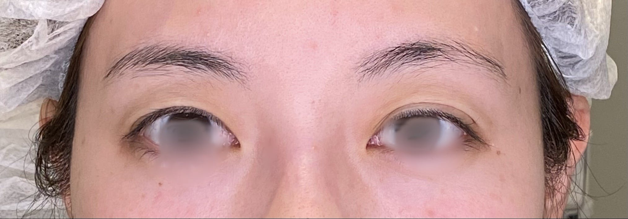 Vclinic 新宿院(ブイクリニック) / 旧:Venus Beauty Clinicでを受けたmmさんの写真