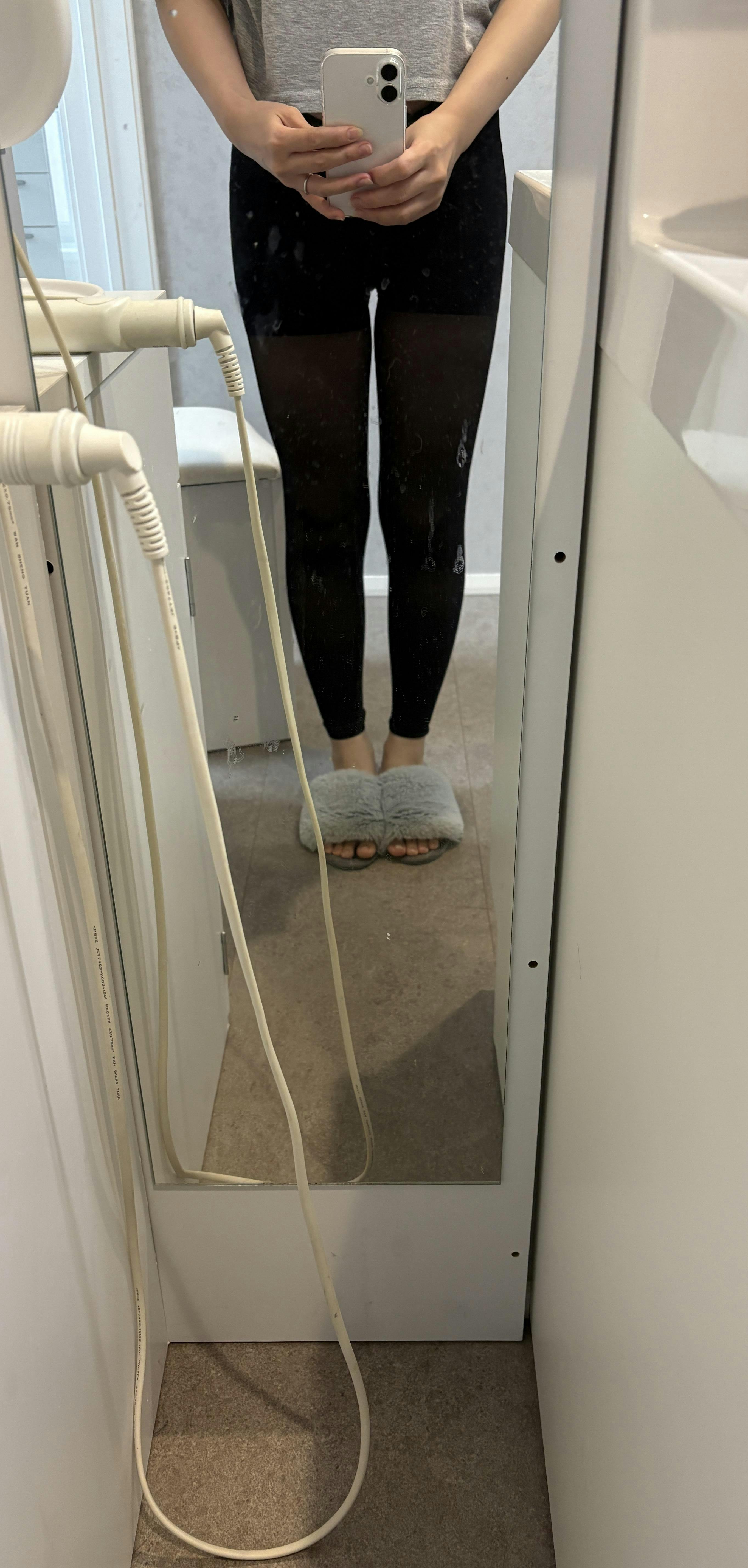 湘南美容クリニック 秋葉原院で太もも尻膝脂肪吸引：美ボディ脂肪吸引を受けたえるりさんの写真