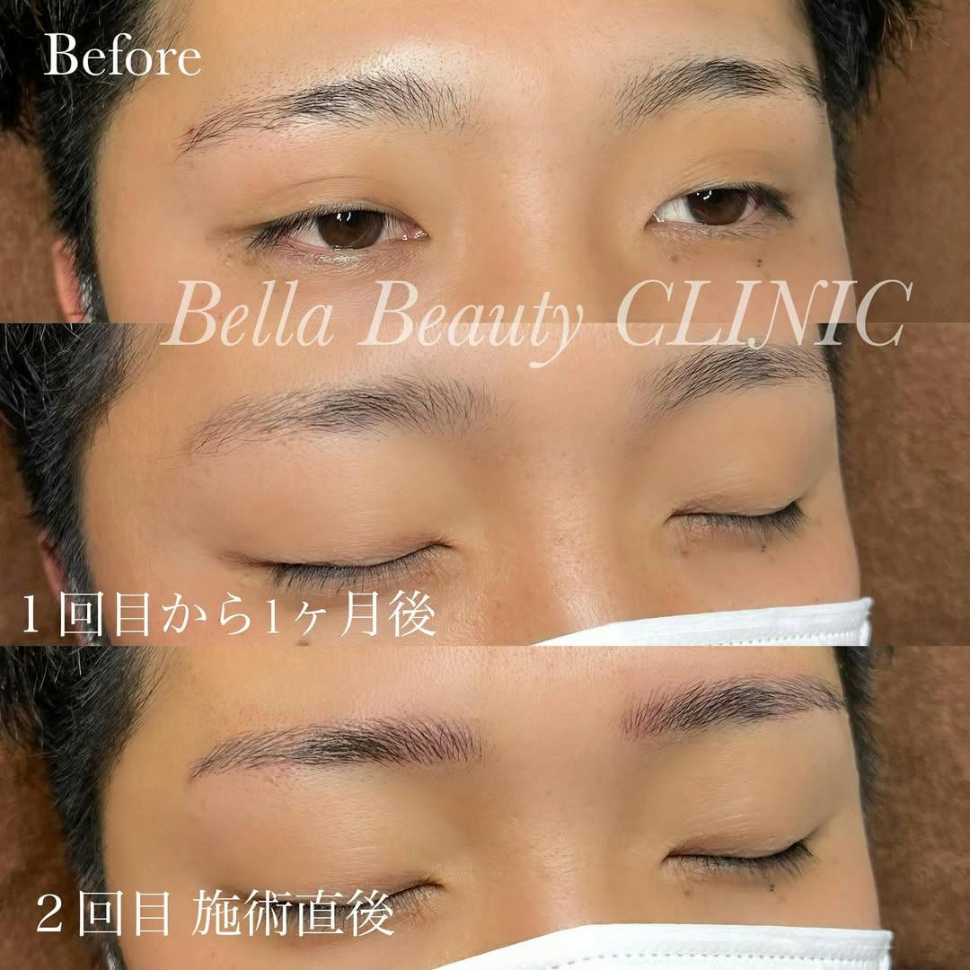 【男性・眉】毛並みアートメイク(3D)_before_aftar