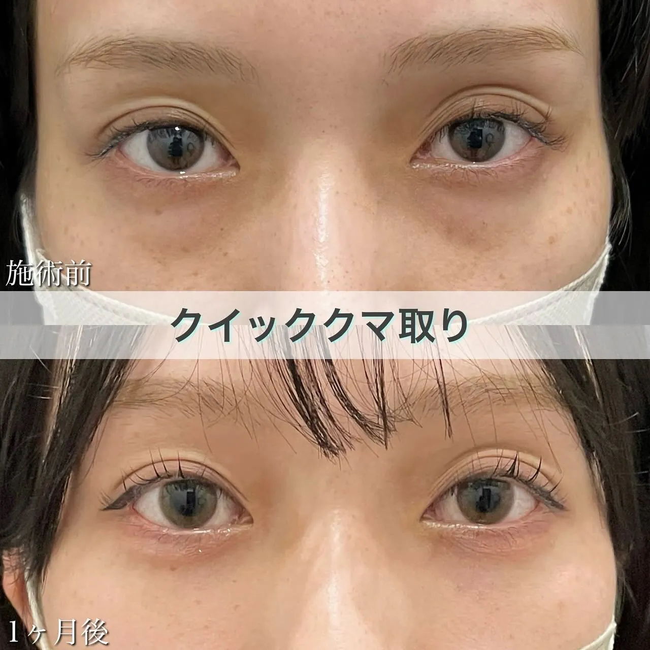 山村 皮膚 科 芦屋