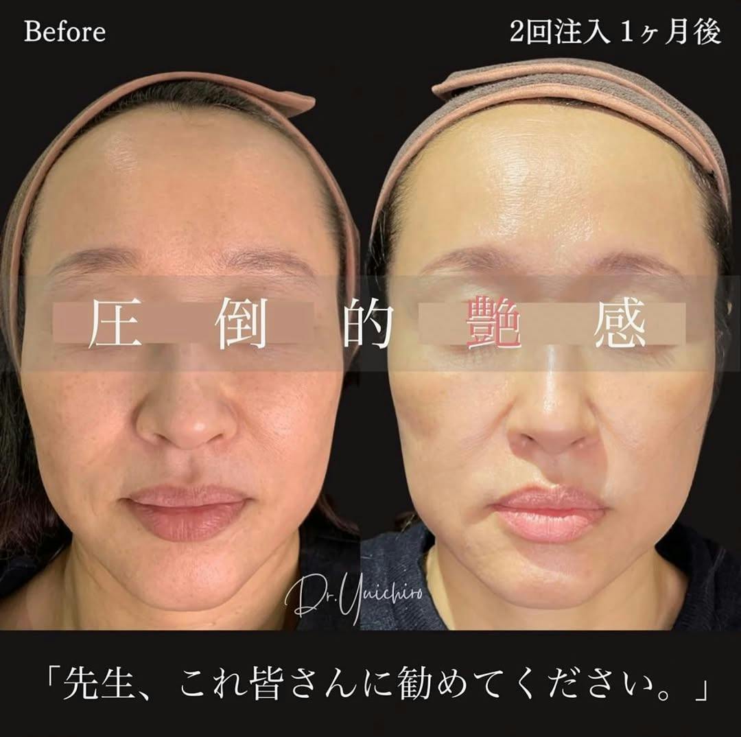 【女性・艶】プロファイロ_before_aftar