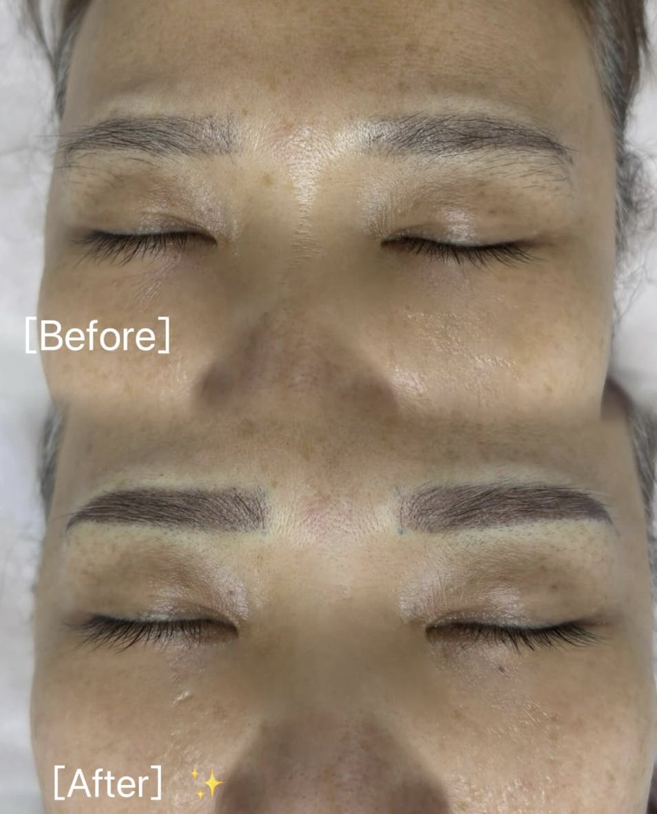 【女性・眉】アートメイク(眉)_before_aftar