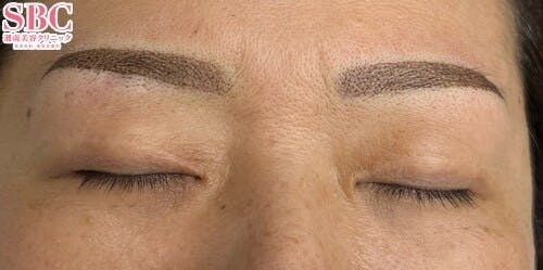 【女性・眉】アートメイク(眉毛)_after