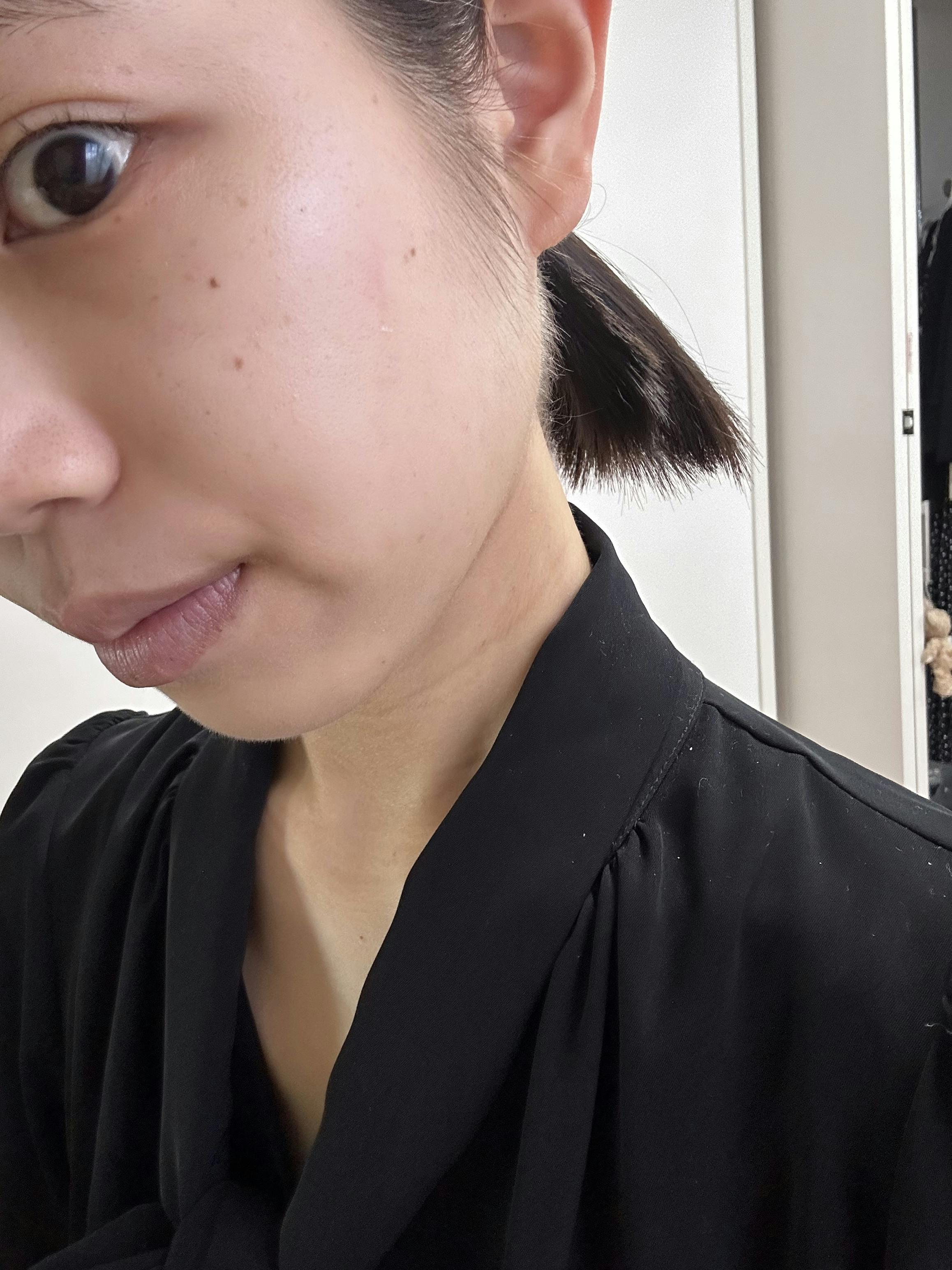 湘南美容クリニック 大阪心斎橋院_フォトダブル