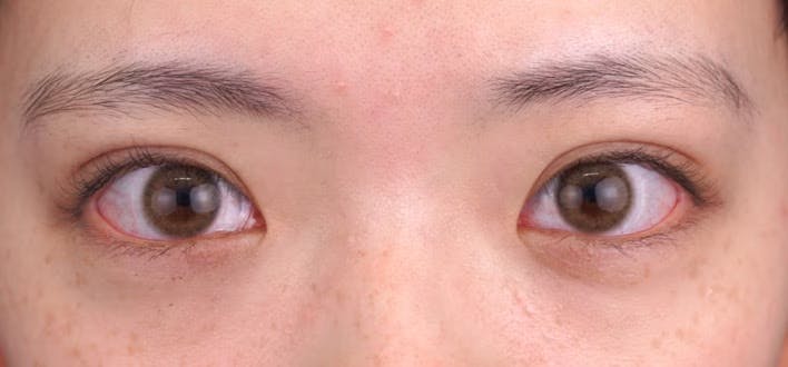 【10代女性・目元】クイックコスメティーク・トリプルNeo_1week