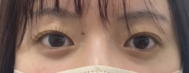 L’or Clinic Omotesando 表参道院(ロールクリニックオモテサンドウ)でを受けたちょもさんの写真