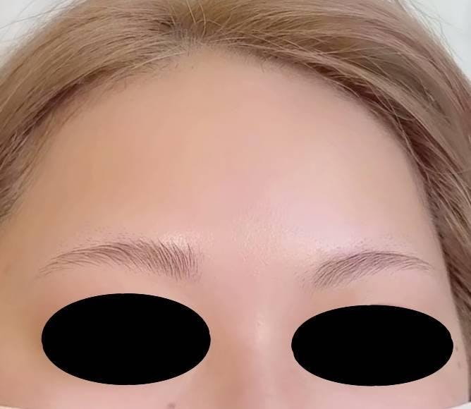 銀座よしえクリニック銀座院でアートメイク（眉）：3D眉を受けたえいちゃんさんの写真