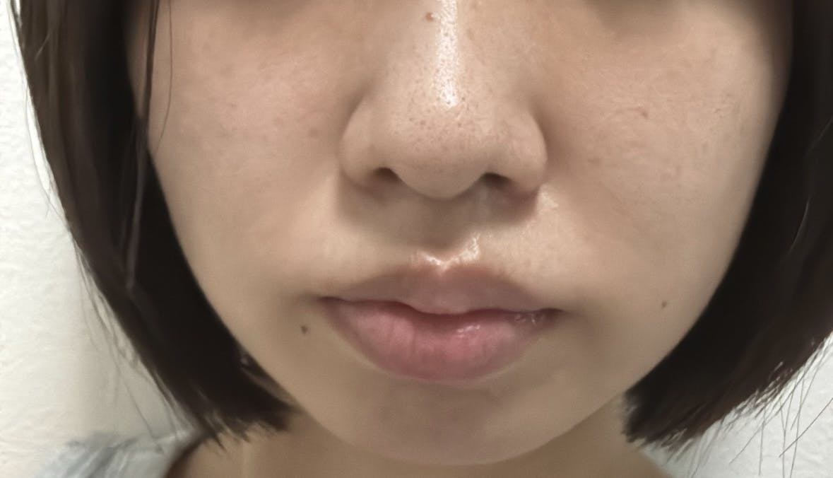 湘南美容クリニック 錦糸町院でエレクトロポレーション・イオン導入を受けたみなさんの写真