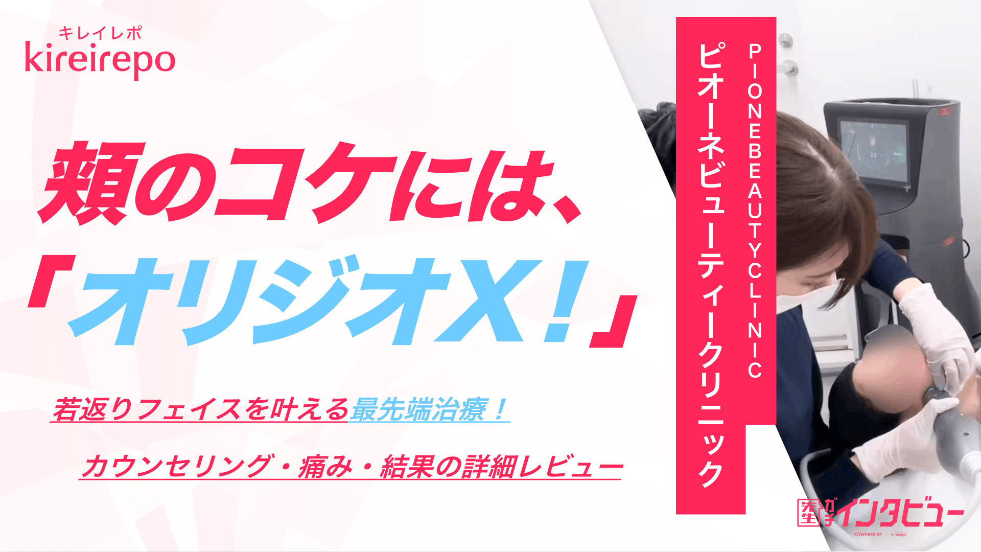 頬のコケにはオリジオX！若返りフェイスを叶える最先端治療～カウンセリング・痛み・結果の詳細レビュー｜ピオーネクリニックのサムネイル