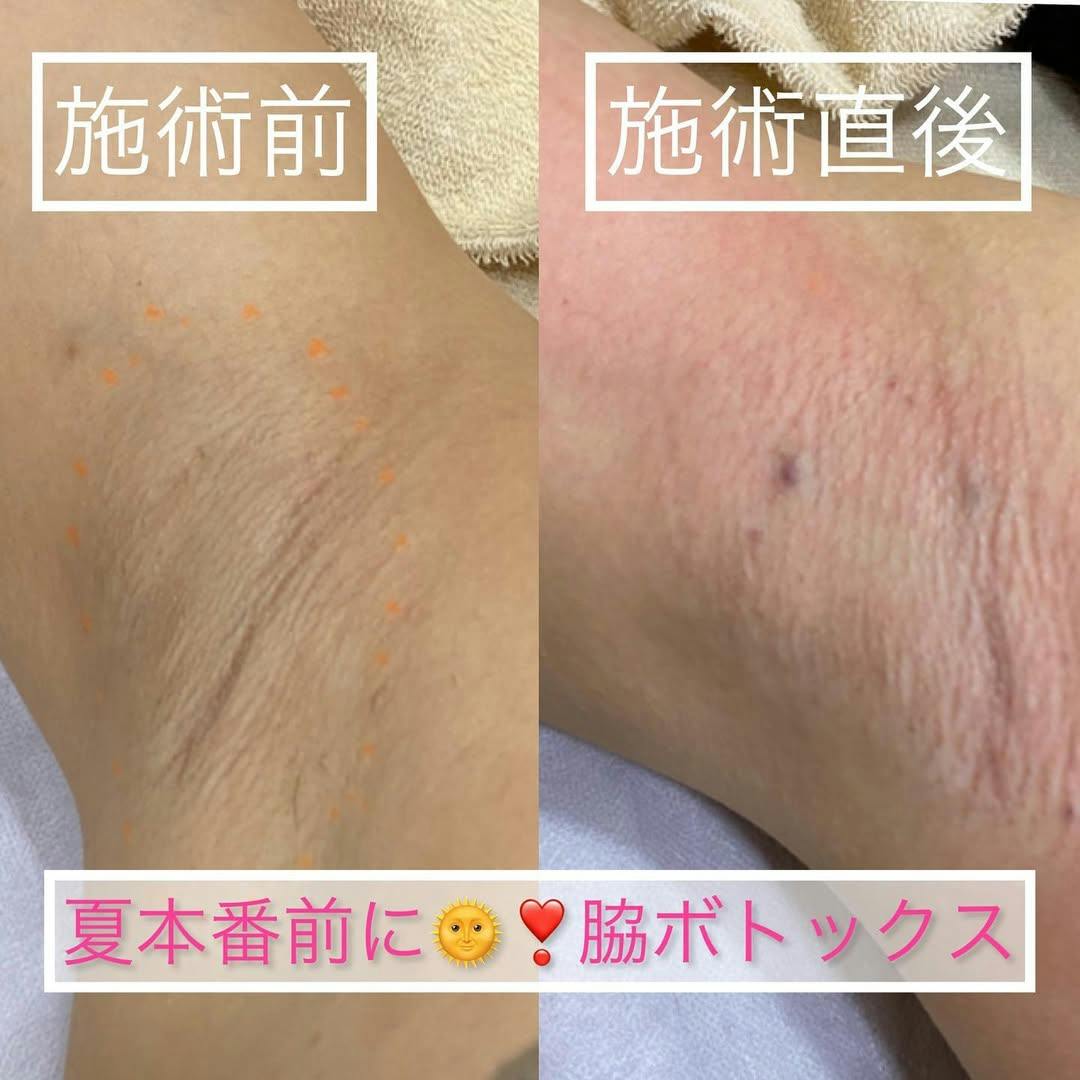 フェミークリニック 池袋院_before_aftar