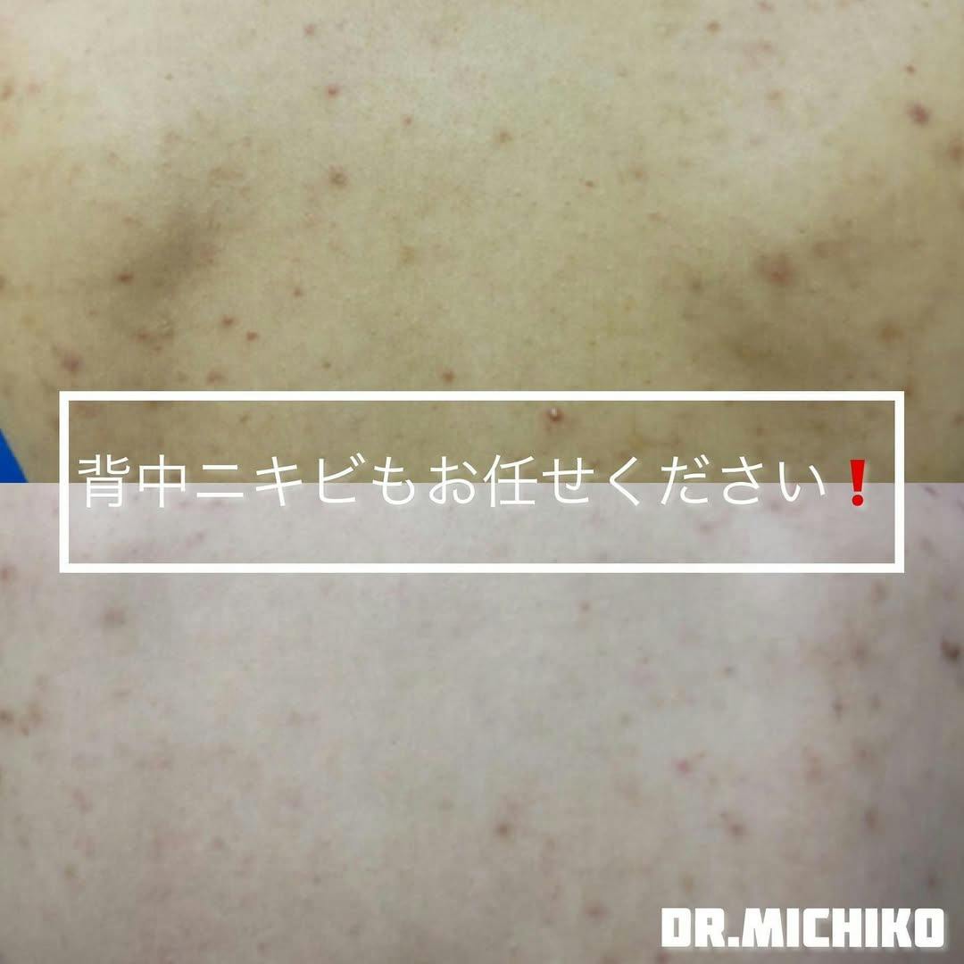 フェミークリニック 池袋院_before_aftar