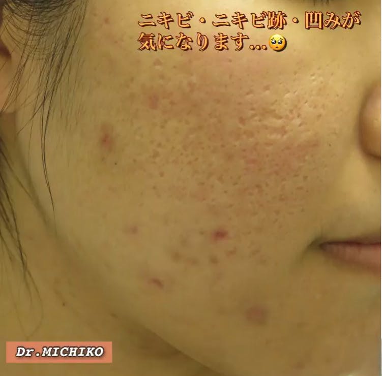 フェミークリニック 池袋院_before