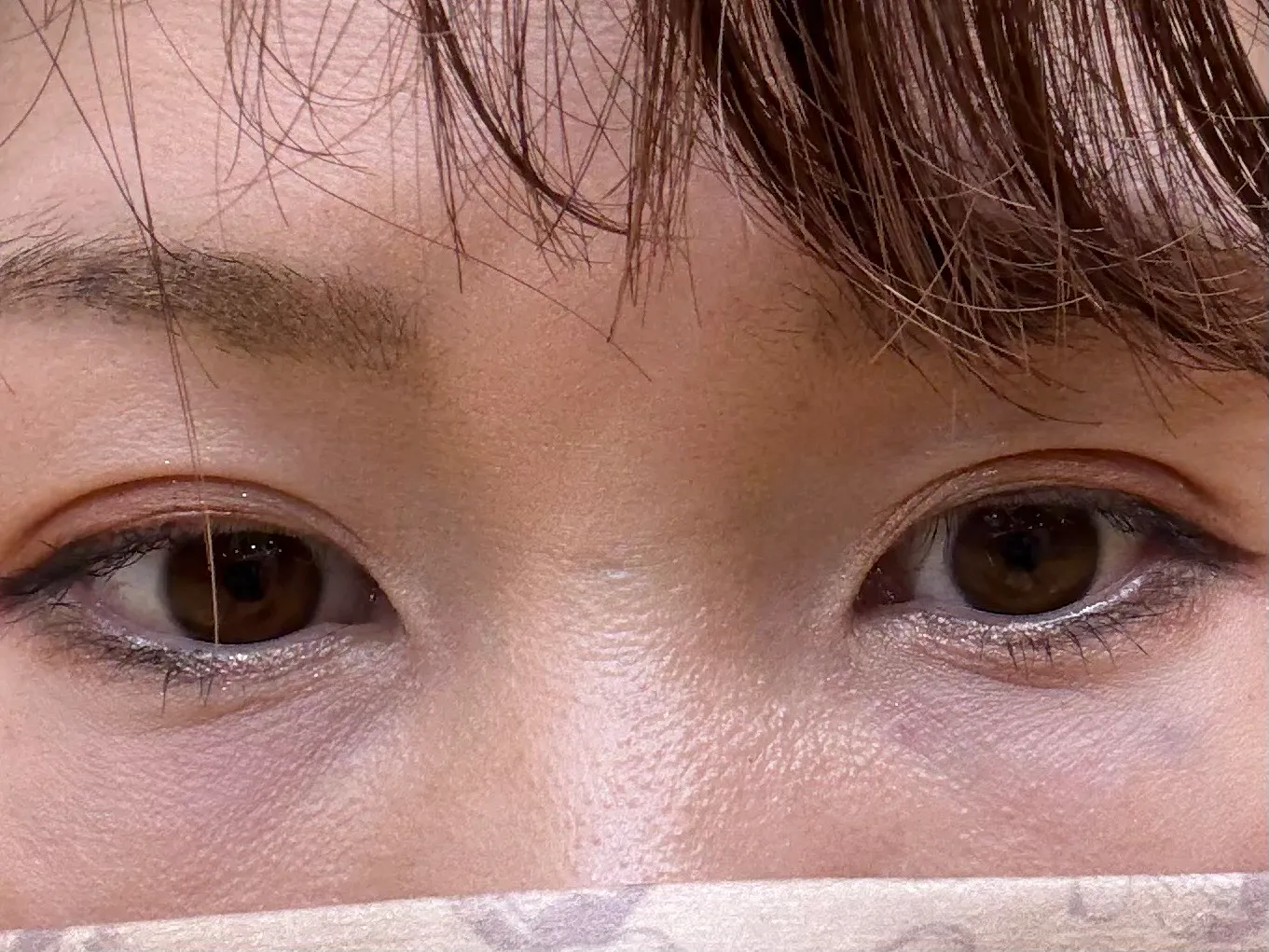 【口コミ・効果】数日疲れがない|品川スキンクリニック宇都宮院(※品川美容外科提携)の口コミ|キレイレポ