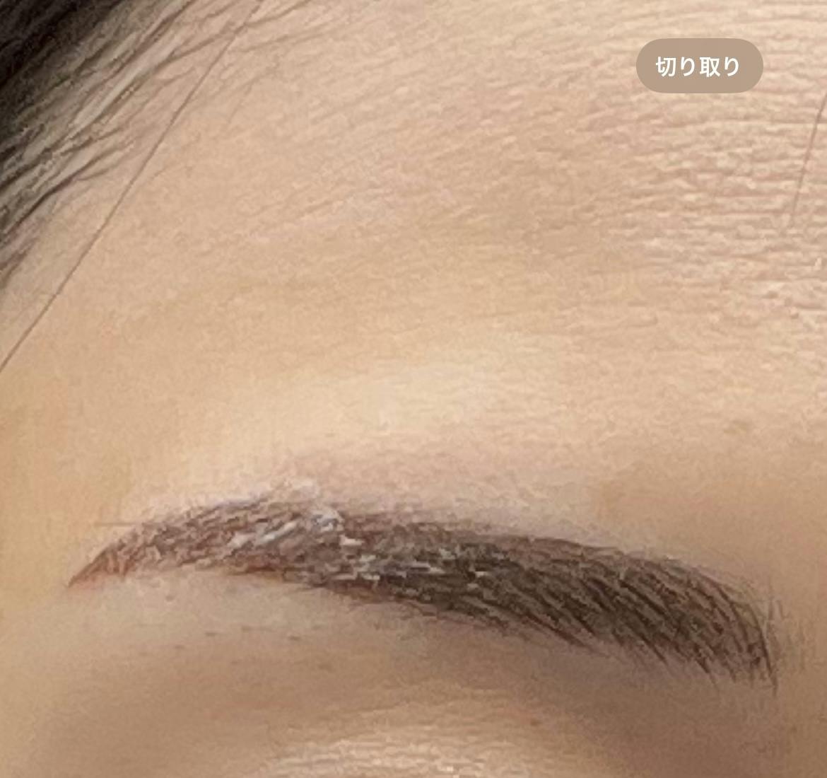 Vclinic 銀座院(ブイクリニック) / 旧:Venus Beauty Clinicで眉アートメイクを受けたすさんの写真