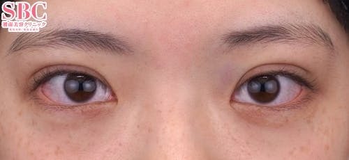 【10代女性・目元】クイックコスメティーク・トリプルNeo_0day