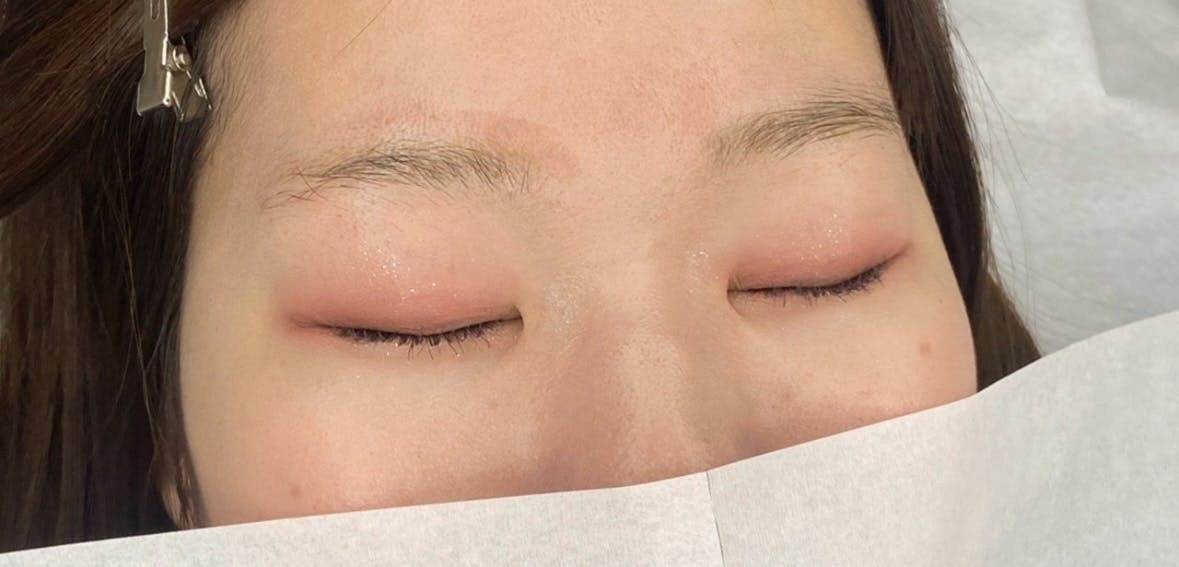 湘南美容クリニック  大阪梅田院で眉アートを受けたpsさんの写真