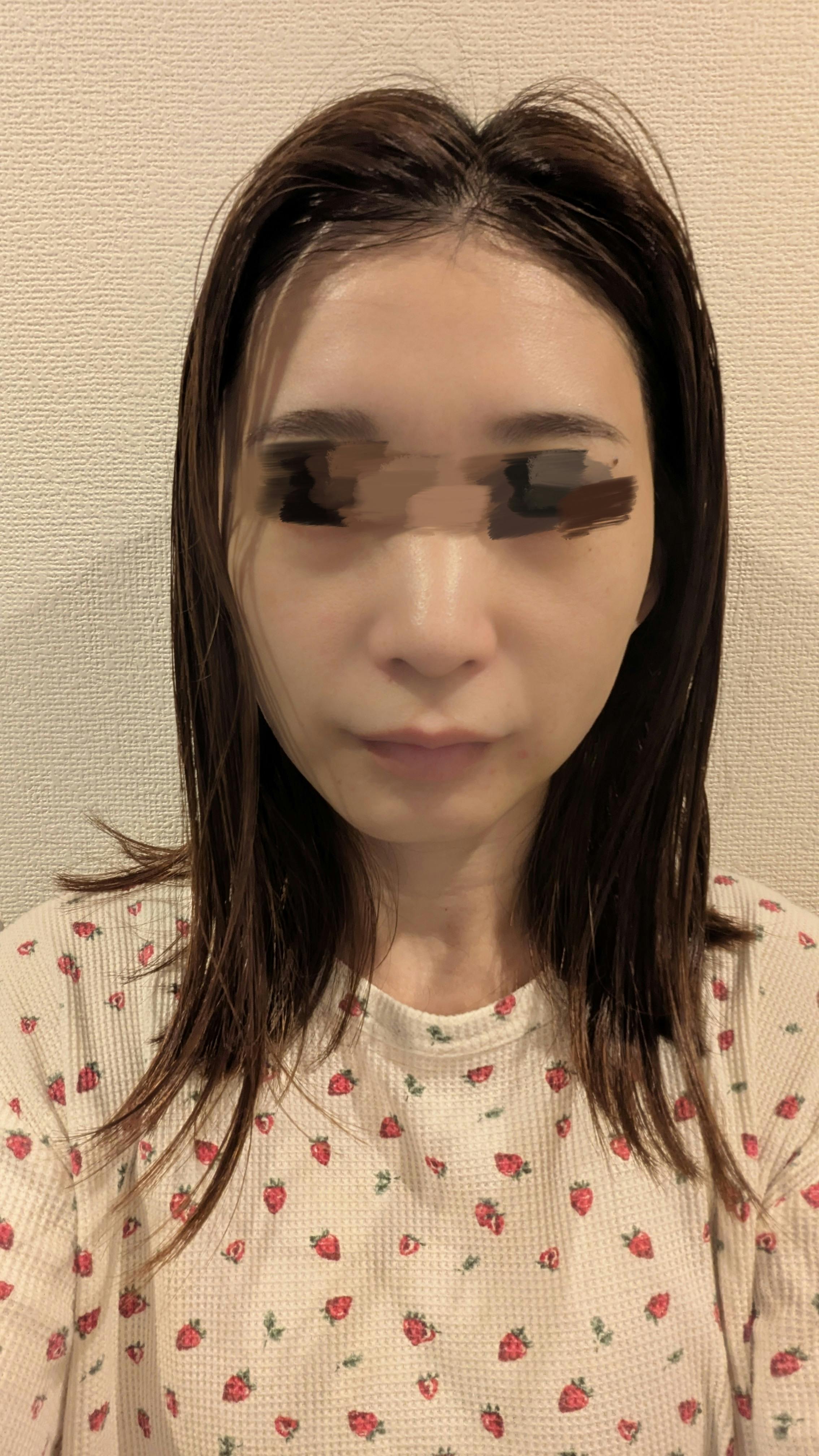 あやクリニックでショッピングリフトを受けたハッピーさんの写真