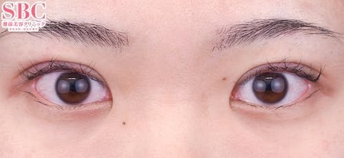 【20代女性・目元】クイックコスメティーク・トリプルNeo_0day