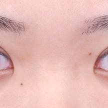 【20代女性・目元】クイックコスメティーク・トリプルNeo_0day