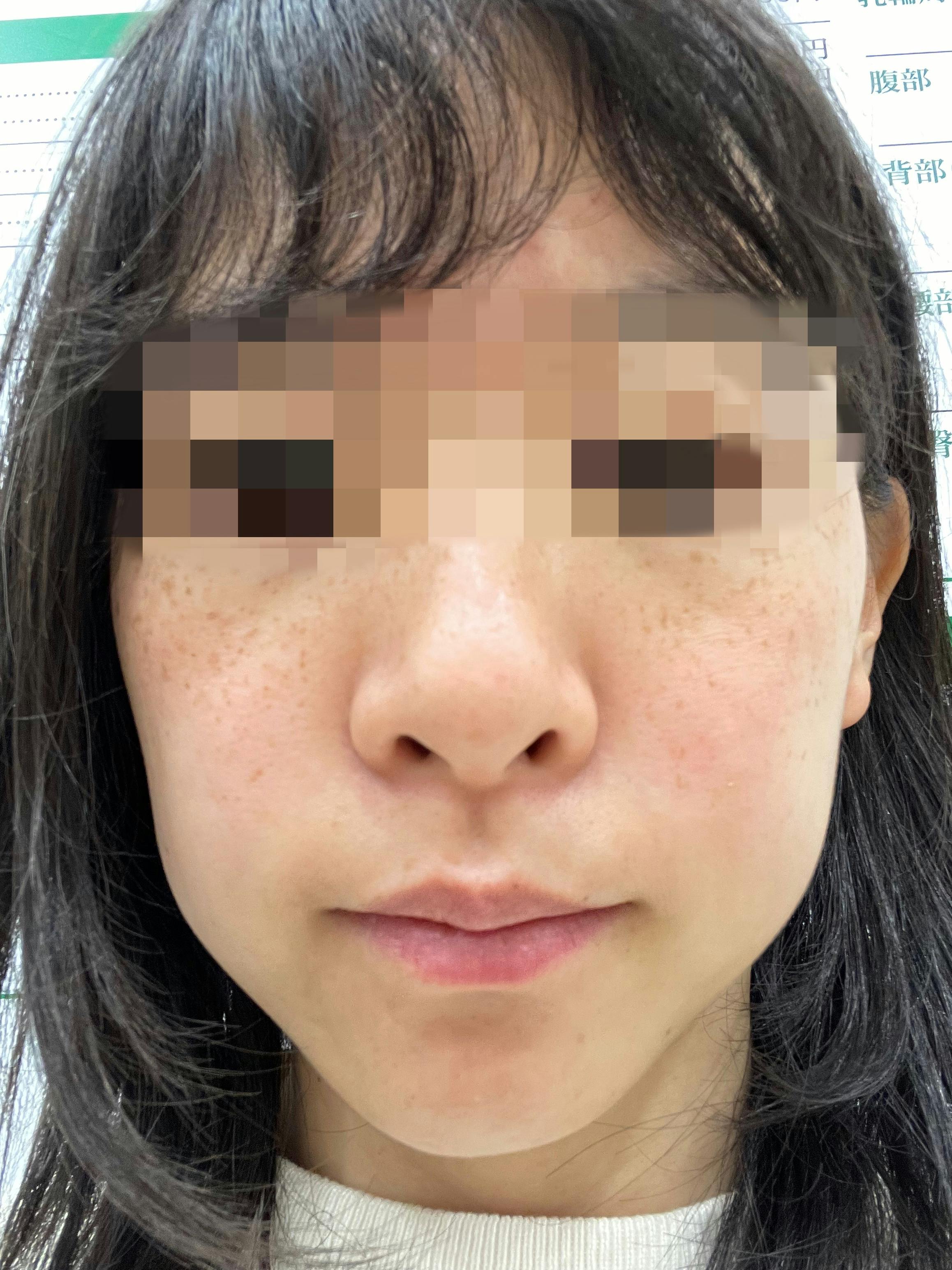 よつば会クリニック 栄・矢場町院でを受けたぽんさんの写真