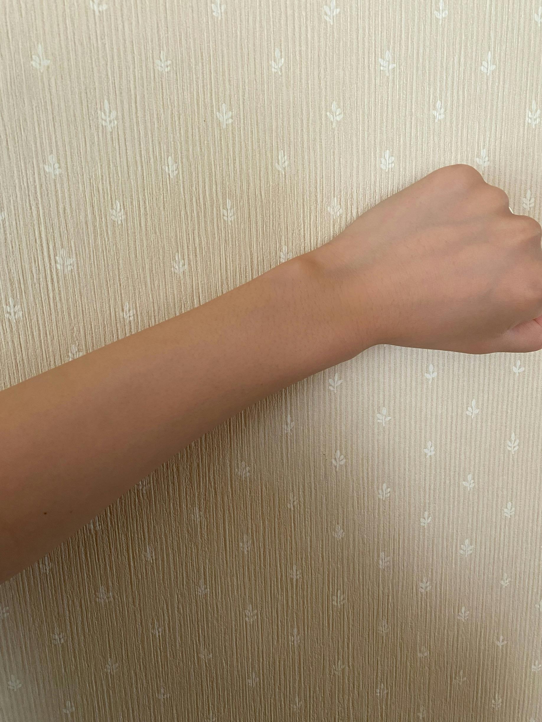 湘南美容クリニック 名古屋院で医療脱毛・胸の医療脱毛・お尻の医療脱毛・腹の医療脱毛・背中の医療脱毛・膝下の医療脱毛・肘下の医療脱毛・太もも・膝上の医療脱毛・肘上の医療脱毛を受けたあいさんの写真