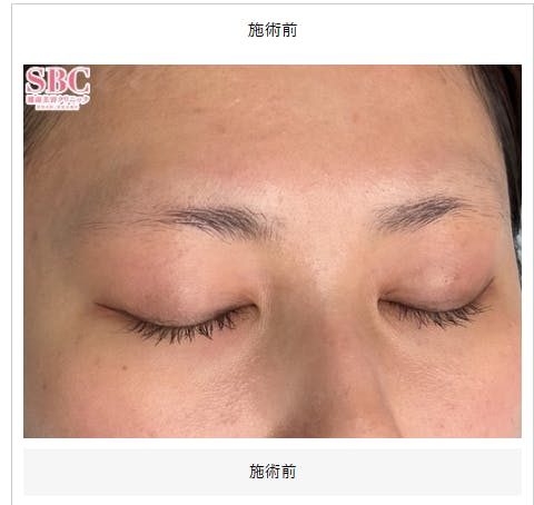 【女性・眉】mocci眉アートメイク（2Dパウダー）_before