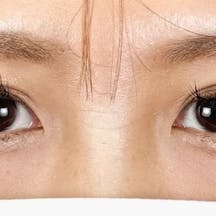 【女性・目元】クイックコスメティーク・トリプルNeo_after