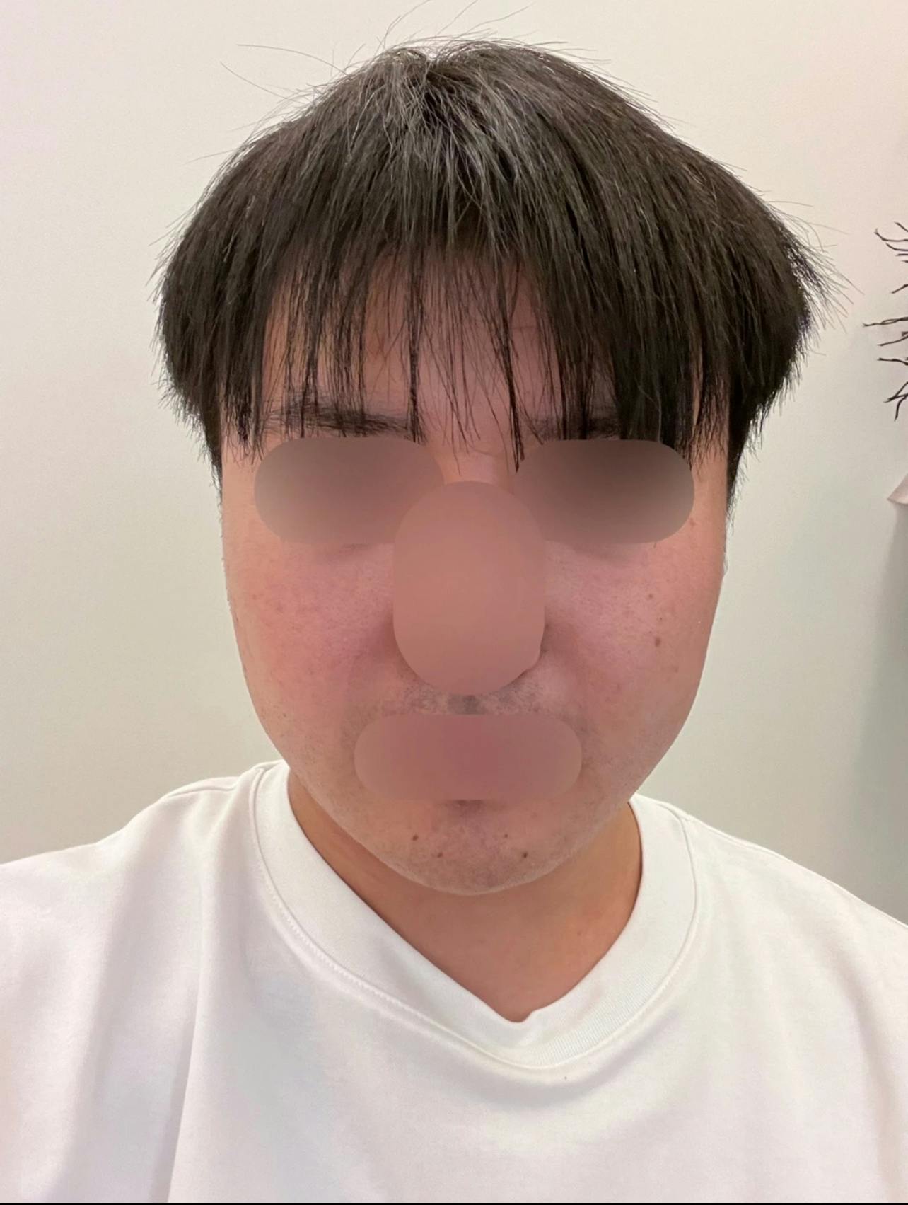 城本クリニック 岐阜院で美容点滴・注射を受けたざわしさんの写真