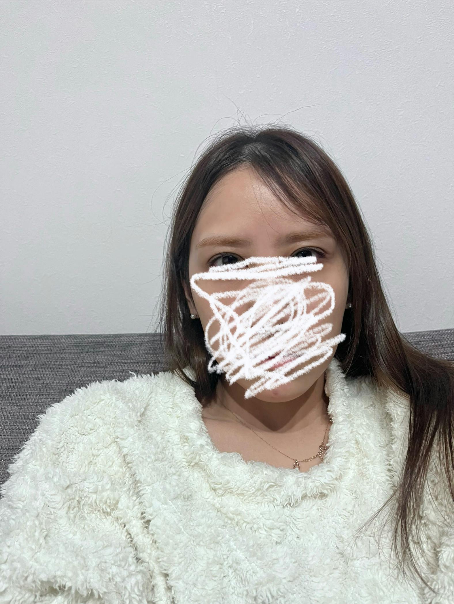 モーブビューティークリニック札幌大通(Mauve Beauty Clinic 札幌大通)でおでこ(額)ボトックス注射を受けたelleriさんの写真