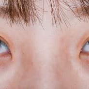 【女性・目元】クイックコスメティーク・シングルNeo、クイックコスメティーク・ダブルNeo_aftar