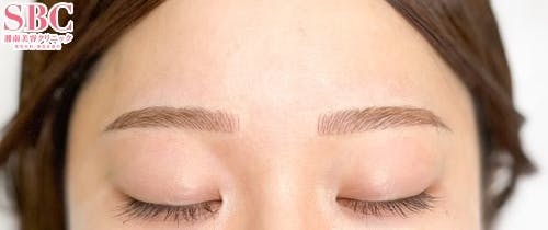【女性・眉】アートメイク(眉毛)_after
