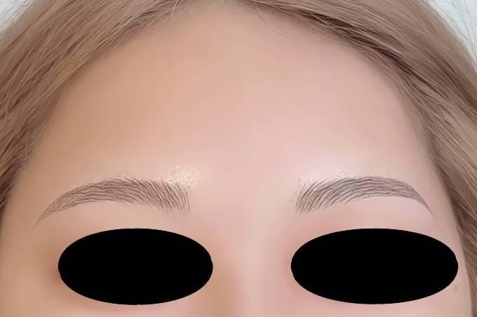 銀座よしえクリニック銀座院でアートメイク（眉）：3D眉を受けたえいちゃんさんの写真