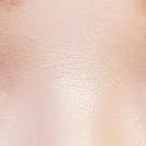 【女性・目元】クイックコスメティーク・シングルNeo、クイックコスメティーク・ダブルNeo、埋没法二重術クイックコスメティーク法_after