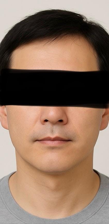シンシアガーデンクリニックメンズ 高崎院でメンズ脱毛を受けたkantaroさんの写真