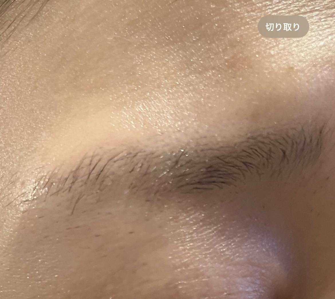 Vclinic 銀座院(ブイクリニック) / 旧:Venus Beauty Clinicで眉アートメイクを受けたすさんの写真