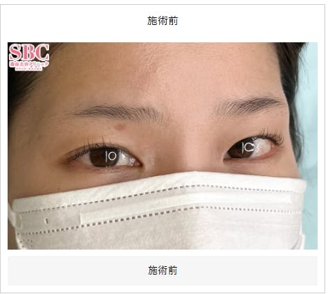 【女性・眉】眉毛_before