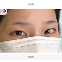 【女性・眉】眉毛_before