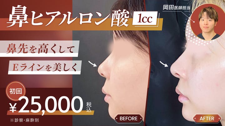 麻布台美容皮膚科クリニック_鼻ヒアルロン酸_FV