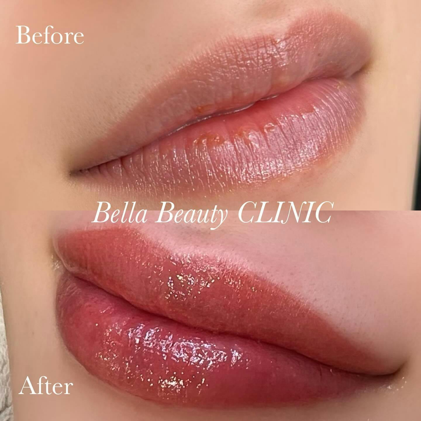 【女性・唇】リップアートメイク_before_aftar