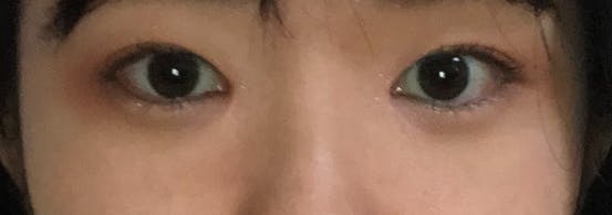 シンデレラ・アンド・ダヴィンチクリニック(Cinderella & Da Vinci Clinic)でを受けたなななさんの写真