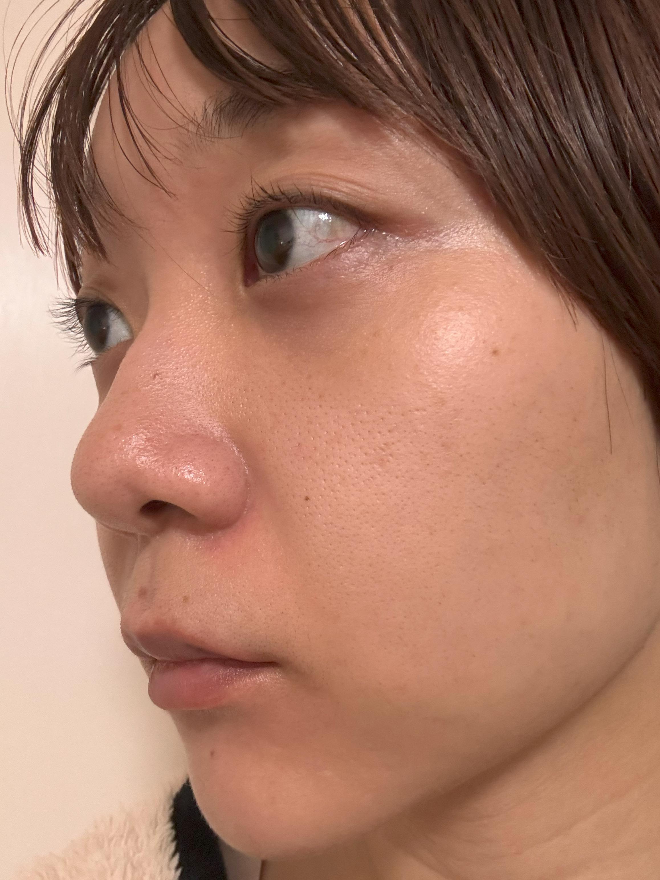 天王寺フェミークリニック(旧 リナクリニック 天王寺院)でを受けたリンノスケさんの写真